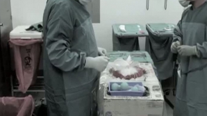 Topul ţărilor care exportă cele mai multe organe pentru operaţii de transplant