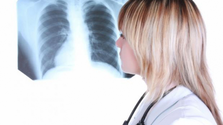 Societatea Italiană de Pneumologie: 30% din persoanele vindecate de coronavirus vor avea o perioadă însemnată probleme respiratorii cronice