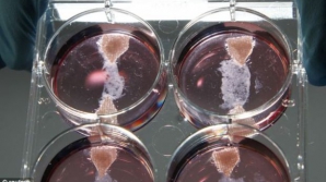 Cercetătorii americani au creat un tip de ţesut muscular care se poate vindeca singur