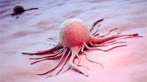 Cancerul ucide tot mai mulţi moldoveni. Datele Ministerului Sănătăţii sunt îngrijorătoare