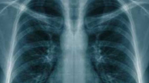 O americancă a devenit multimiliardară pe cancerul soţului decedat DETALII