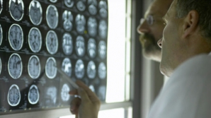 Oamenii de ştiinţă din Anglia ar putea oferi o nouă speranţă persoanelor afectate de boala Alzheimer