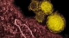 Virusul respirator MERS a ajuns în centrul Europei. Ce ţară a intrat în alertă