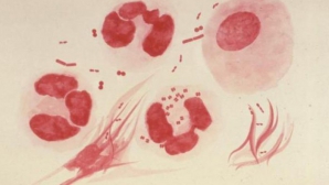 Medicii TRAG UN SEMNAL DE ALARMĂ. O boală cu transmitere sexuală ar putea să devină incurabilă