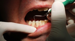 Cel mai mare mit despre molarii de minte a fost distrus. Care este ROLUL lor în organismul uman