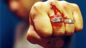 S-au bătut ca chiorii în scara blocului. Cine este vinovat