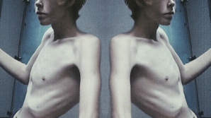 Şi bărbaţii pot suferi de ANOREXIE! Îi plângi de milă la cum arat acest tânăr (FOTO)