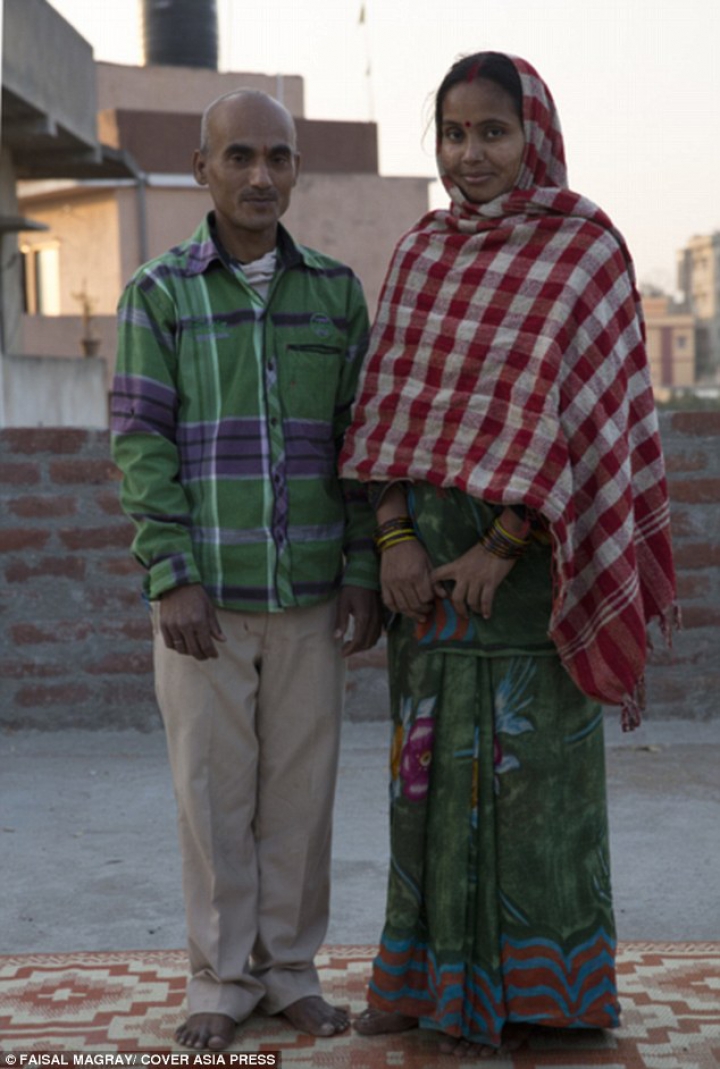 Nu s-au născut ca şi noi. Doi copii din India suferă de o boală genetică foarte rară (FOTO)