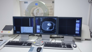 Cel mai performant tomograf din UE, acum şi în Moldova. Cât costă investigaţiile