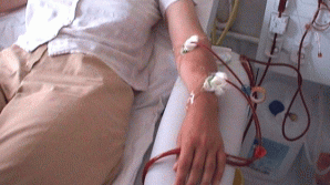 O șansă pentru bolnavii de insuficienţă renală. În Moldova va apărea Registrul Naţional Renal