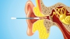 Bine de știut! De ce să NU folosești bastonașele de vată pentru a curăța urechile (VIDEO)