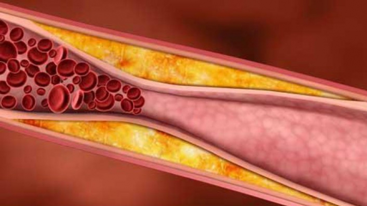 DESCOPERIRE SURPRINZĂTOARE! Fructul care scade colesterolul la fel de rapid ca medicamentele