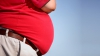 Obezitatea, o problemă globală. Ce loc ocupă Moldova în topul celor mai supraponderale națiuni