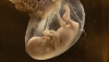 La limita moralului. În Japonia s-a permis modificarea  GENETICĂ a embrionilor umani