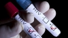 SUNT ÎN PERICOL! Aproape jumătate dintre moldovenii infectaţi cu HIV, diagnosticaţi tardiv