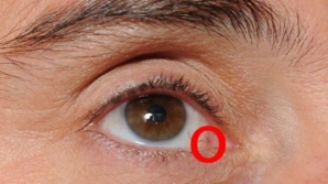 ATENŢIE! Aceasta este boala gravă care ţi se poate citi în ochi