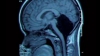 Detaliul şocant descoperit de medici la o radiografie de rutină: Pacienta aceasta nu ar trebui să trăiască