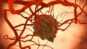 Cercetătorii sunt optimiști! Un posibil remediu care tratează cancerul, descoperit din greșeală