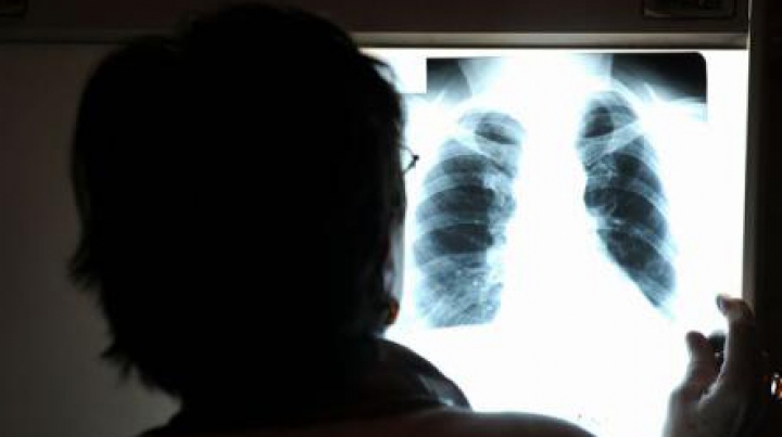 VESTE BUNĂ! A fost descoperit un nou tratament pentru pacienții diagnosticați cu tuberculoză