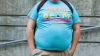 STUDIU: Obezitatea în perioada adolescentină afectează grav sănătatea oaselor