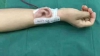 INCREDIBIL! Medicii au reușit să crească o ureche pe mâna unui bărbat (FOTO)