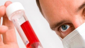 O nouă metodă de diagnostic a cancerului limfatic, descoperită de savanţii noştri