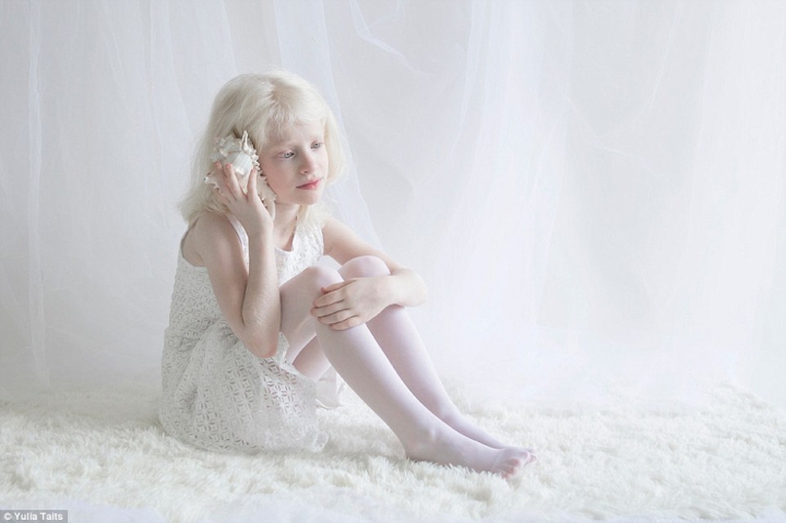 IMAGINI SUPERBE! Frumuseţea oamenilor albinoşi pare ruptă din basme (GALERIE FOTO)