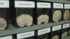 Sute de creiere bolnave sunt expuse într-un muzeu din Lima 