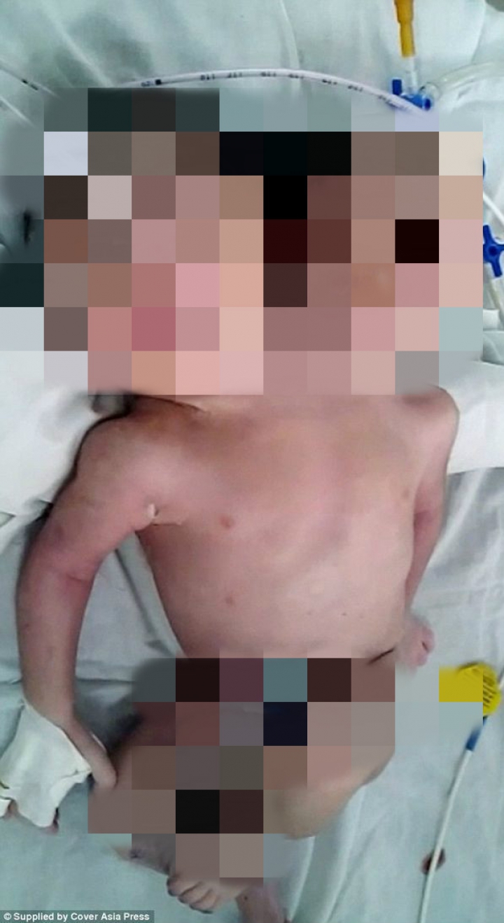 IMAGINI ŞOCANTE! O femeie a născut un copil cu două capete (FOTO)