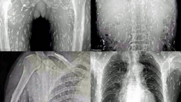 Îl mânca pielea foarte tare şi a mers la un control. Medicii AU RĂMAS ŞOCAŢI când au descoperit ce avea