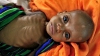 Stare de foamete în Sudanul de Sud: Peste 40% din populaţia ţării au nevoie urgentă de alimente