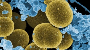 Descoperire UIMITOARE! Cremă din propriile bacterii