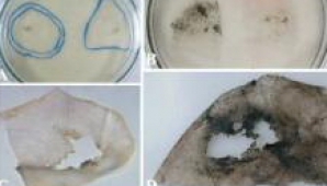 REVOLUŢIONAR! A fost descoperită o nouă ciupercă în stare să descompună materiale plastice