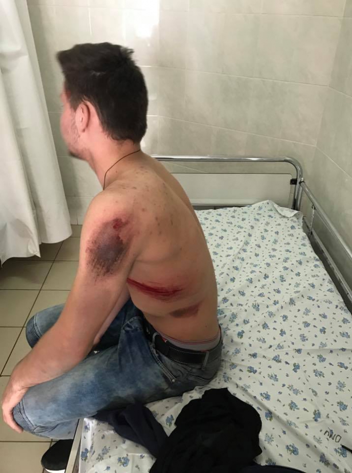 RECUNOŞTI numărul de înmatriculare? Şoferiţa a accidentat un tânăr şi a fugit de la faţa locului (FOTO)