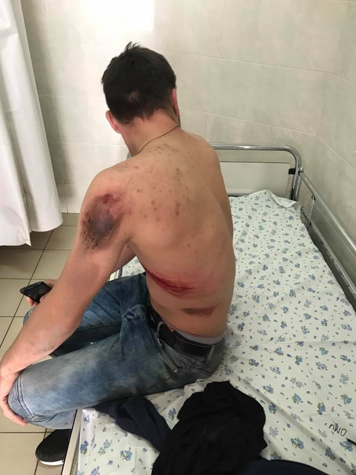 RECUNOŞTI numărul de înmatriculare? Şoferiţa a accidentat un tânăr şi a fugit de la faţa locului (FOTO)