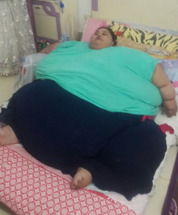 Cea mai obeză femeie din lume a slăbit 240 kg în două luni, dar familia îi acuză acum pe medici de un lucru grav (FOTO)