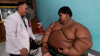 Un copil de 10 ani, care cântăreşte 192 de kilograme, a început să slăbească. Ce spun medicii