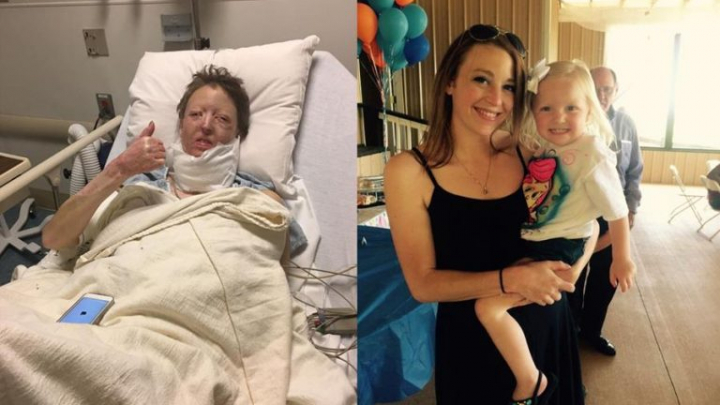 Abandonată de soț după ce o explozie a desfigurat-o: "L-am implorat să se întoarcă, copilul meu nu merita asta" (FOTO)