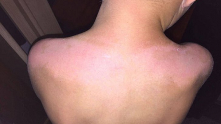 Şocul unei mame, după ce şi-a dat copiii cu loţiune de plajă cu SPF 50 (FOTO)