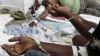 Epidemie de febră dengue în Sri Lanka. Zeci de mii de infectări şi circa 300 de decedaţi  