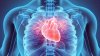 A fost descoperit un TEST care poate depista instant infarctul