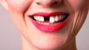 Bine de știut! Ce înseamnă când visezi că îți cad dinții. Legătura dintre vis și moarte