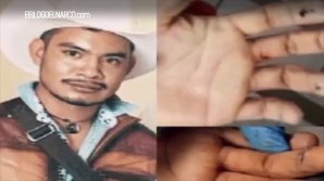 Liderul unei bande criminale din Mexic, asasinat in timpul unei operatii estetice de schimbare a fizionomiei