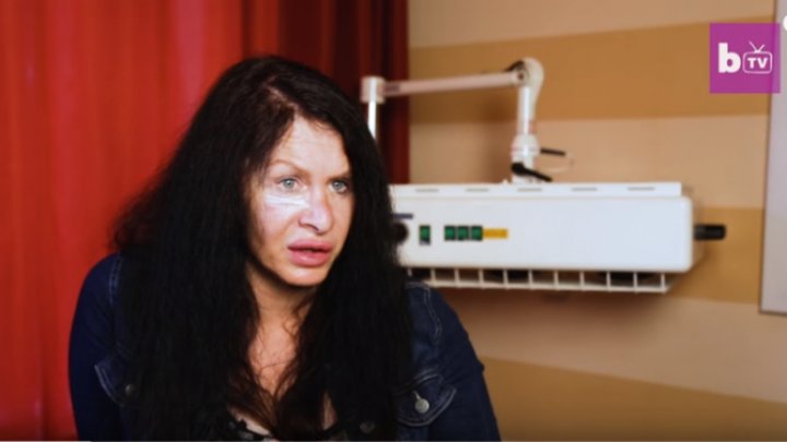 TINEREŢE FĂRĂ BĂTRÂNEŢE. Cum a ajuns să arate o femeie care şi-a injectat o bacterie veche de 3,5 milioane ani (FOTO)