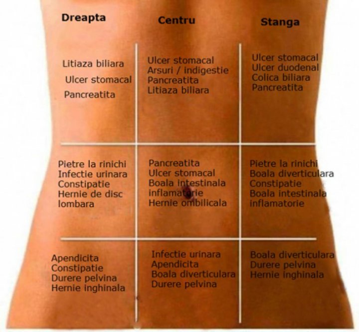 Bine de știut! Harta durerilor de stomac. Care este CAUZA ascunsă, în funcţie de zonă