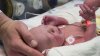 Premieră medicală în SUA. O femeie cu uter transplantat a născut un bebeluş sănătos