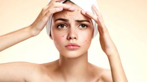 Ce trebuie să mănânci ca să eviţi apariția acneei