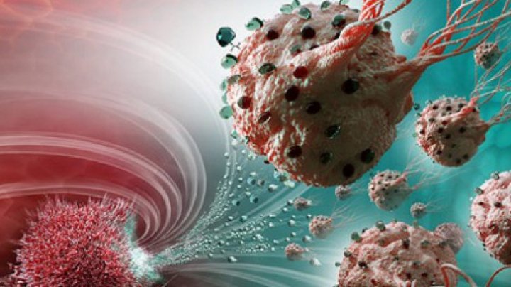 Bine de știut! Semnul care anunţă cancerul pancreatic. Mergi urgent la medic dacă ai acest simptom