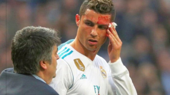 Cristiano Ronaldo, plin de sânge. S-a accidentat în timpul unui meci de fotbal