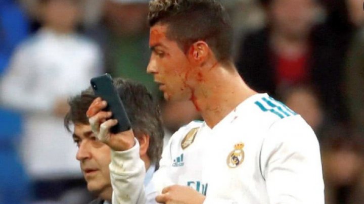 Cristiano Ronaldo, plin de sânge. S-a accidentat în timpul unui meci de fotbal